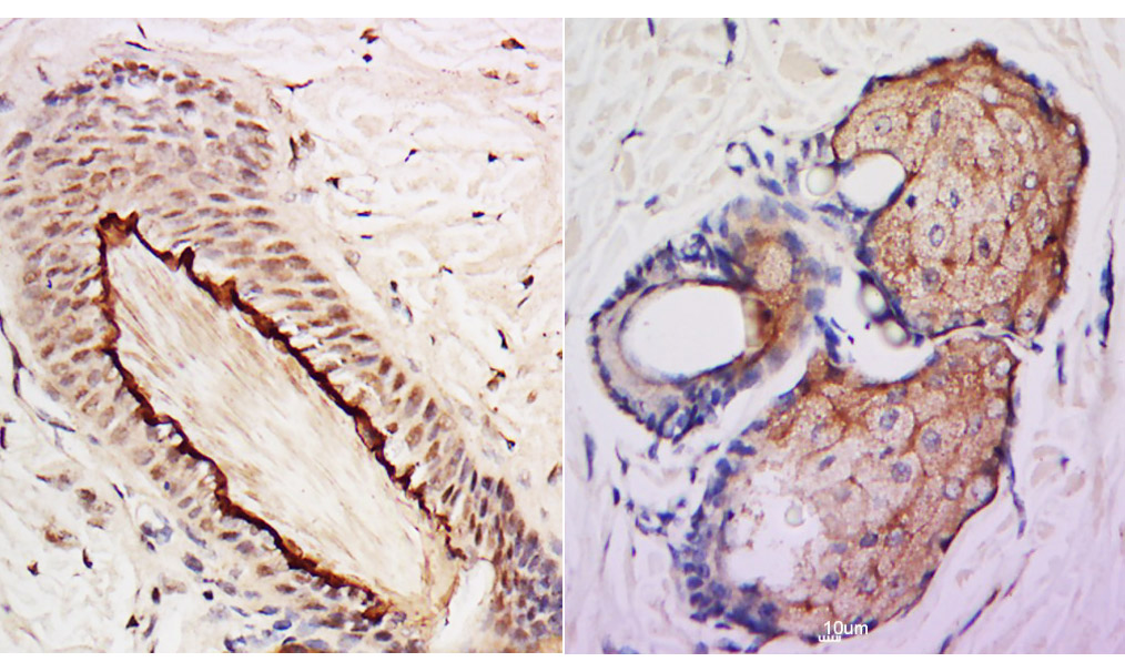 DSS1 Rabbit pAb (一抗) | Bioss