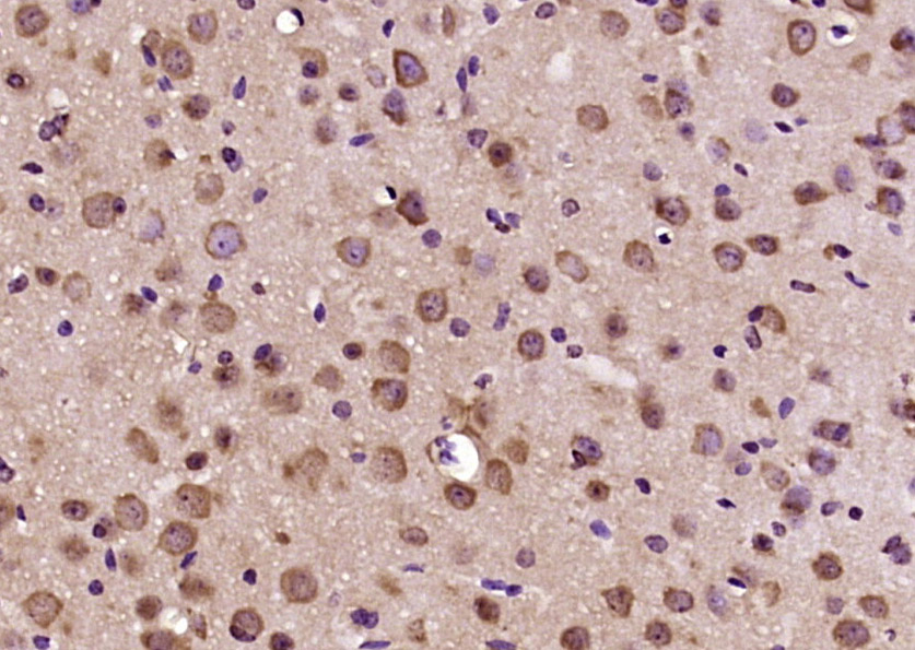 Dynein light chain 2, cytoplasmic Rabbit pAb (一抗) | Bioss