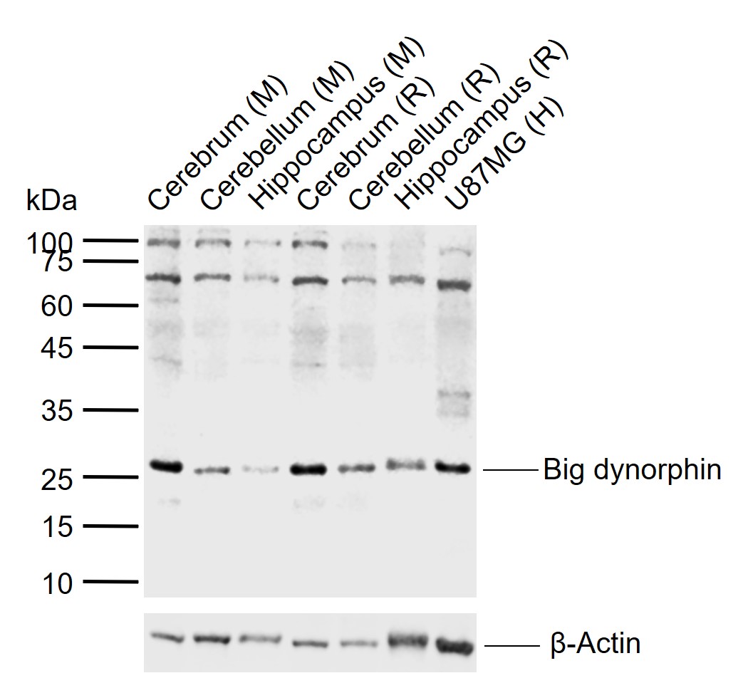 Big dynorphin Rabbit pAb (一抗) | Bioss