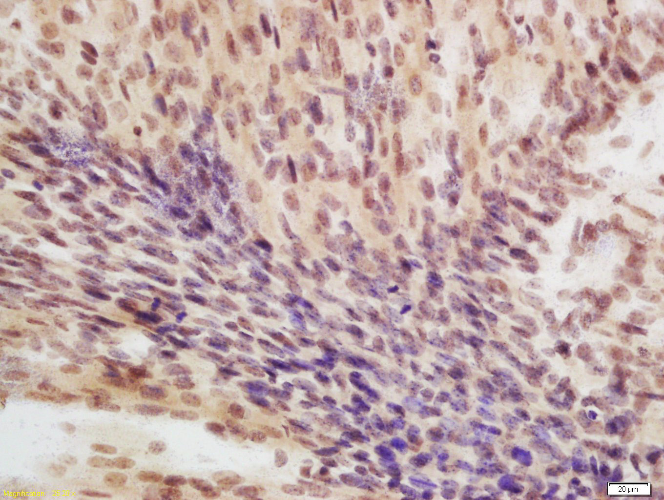 eIF4A3蛋白抗体-bs-14548R