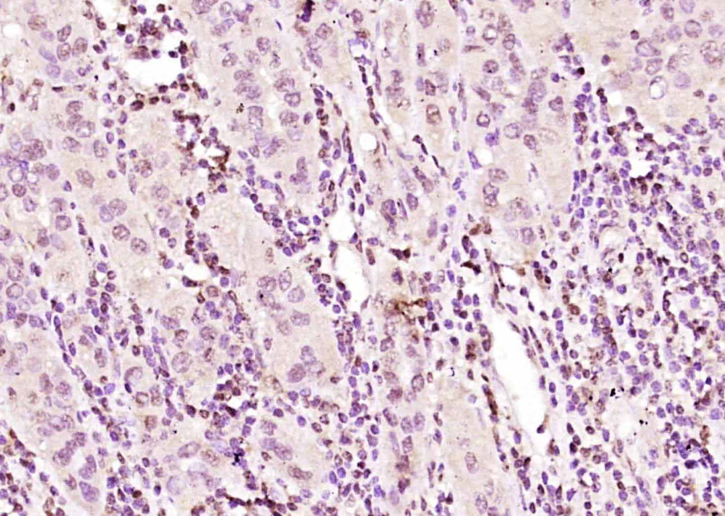 eIF4A3蛋白抗体-bs-14548R