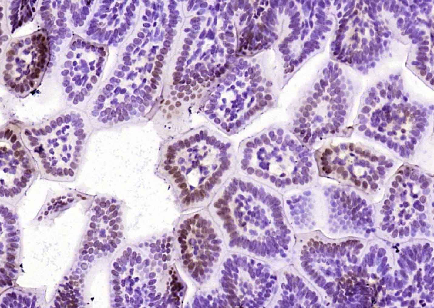 eIF4A3蛋白抗体-bs-14548R