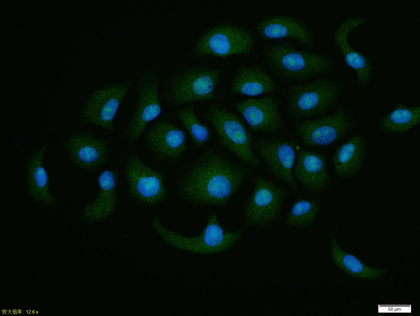 eIF4A3蛋白抗体-bs-14548R