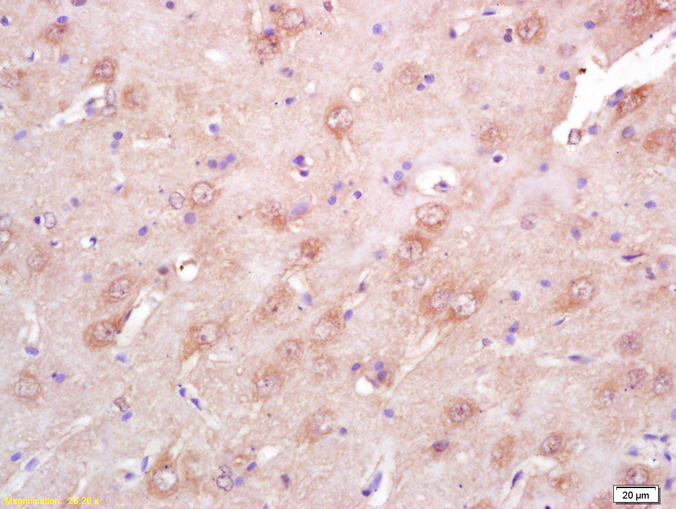 EphA4 R Rabbit pAb (一抗) | Bioss