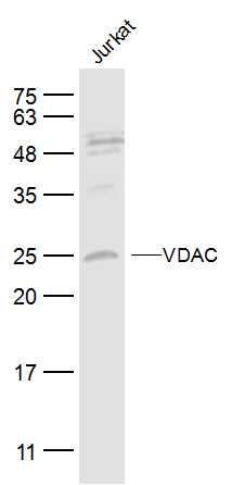VDAC Rabbit pAb, Loading Control (一抗) | Bioss