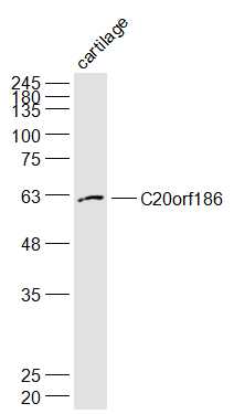 C20orf186 Rabbit pAb (一抗) | Bioss