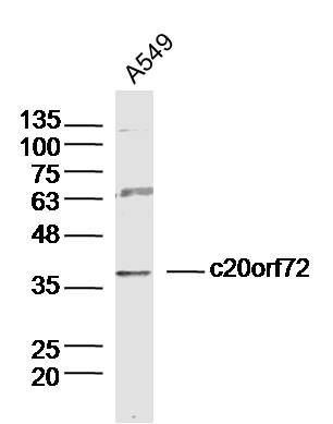 c20orf72 Rabbit pAb (一抗) | Bioss