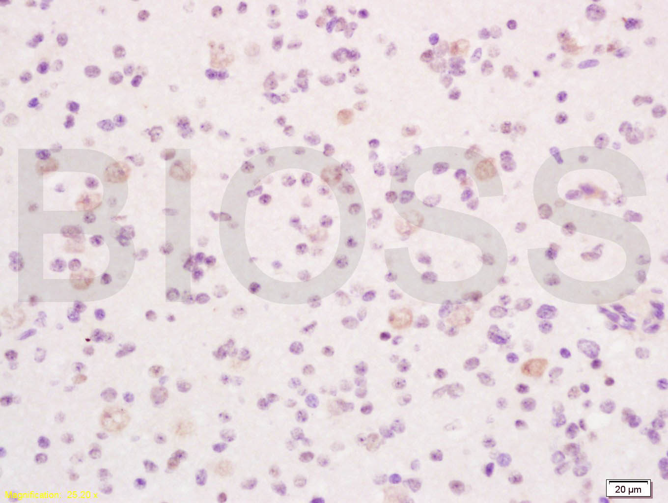 磷酸化丝氨酸/苏氨酸蛋白激酶抗体-bs-1532R