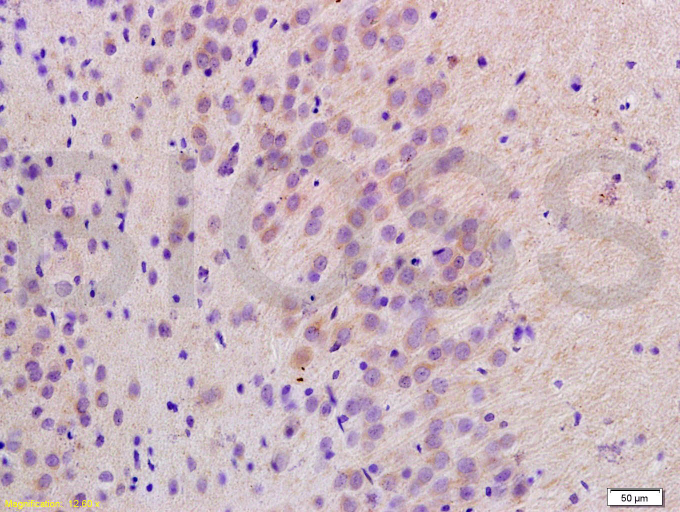 细胞色素c氧化酶IV亚型1抗体-bs-1533R