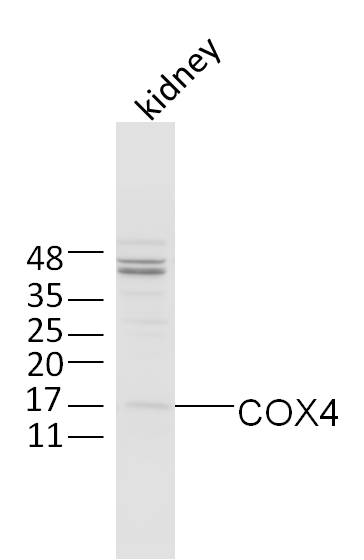 细胞色素c氧化酶IV亚型1抗体-bs-1533R