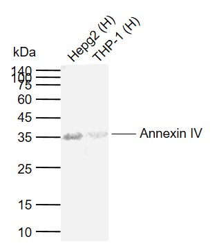 Annexin  IV Rabbit pAb (一抗) | Bioss