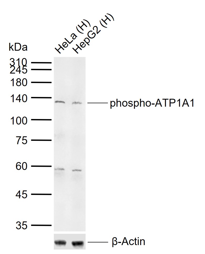 phospho-ATP1A1 (Tyr260) Rabbit pAb (一抗) | Bioss