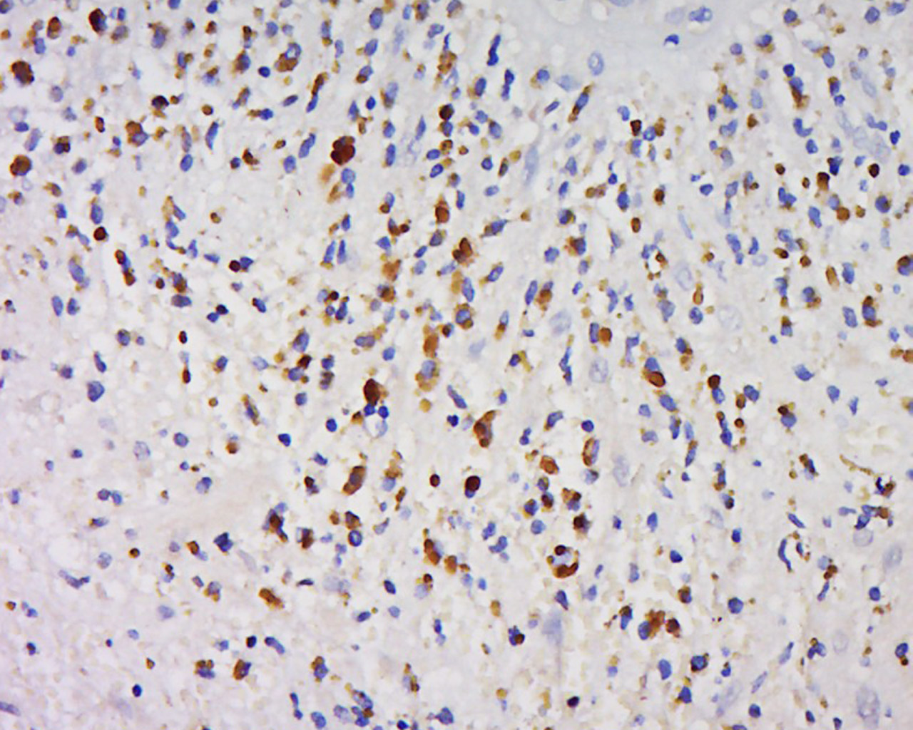 GPIHBP1 Rabbit pAb (一抗) | Bioss