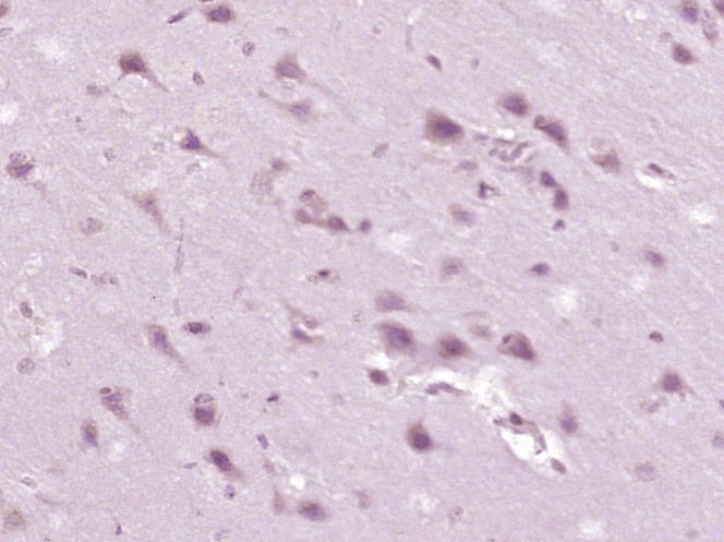 磷酸化钙/钙调素依赖蛋白激酶2α抗体-bs-1647R