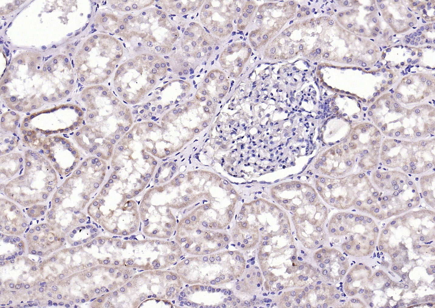 磷酸化钙/钙调素依赖蛋白激酶2α抗体-bs-1647R