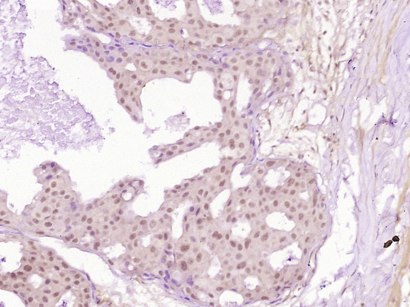 磷酸化细胞肿瘤抗原P53抗体-bs-1650R