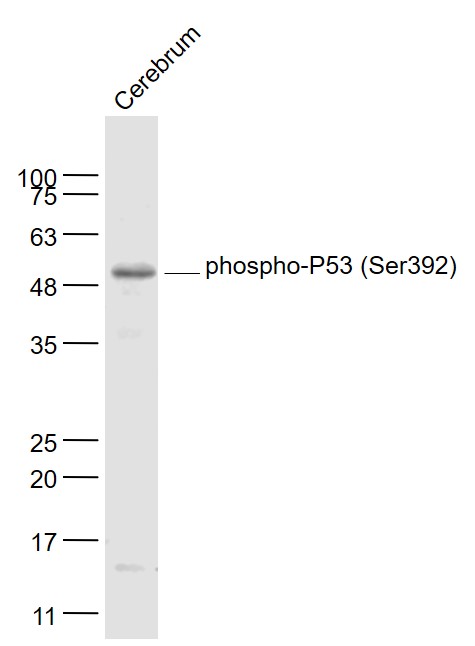 phospho-P53 (Ser392) Rabbit pAb (一抗) - WB,IHC-P,IHC-F,IF,Flow-Cyt,ICC/IF | Bioss
