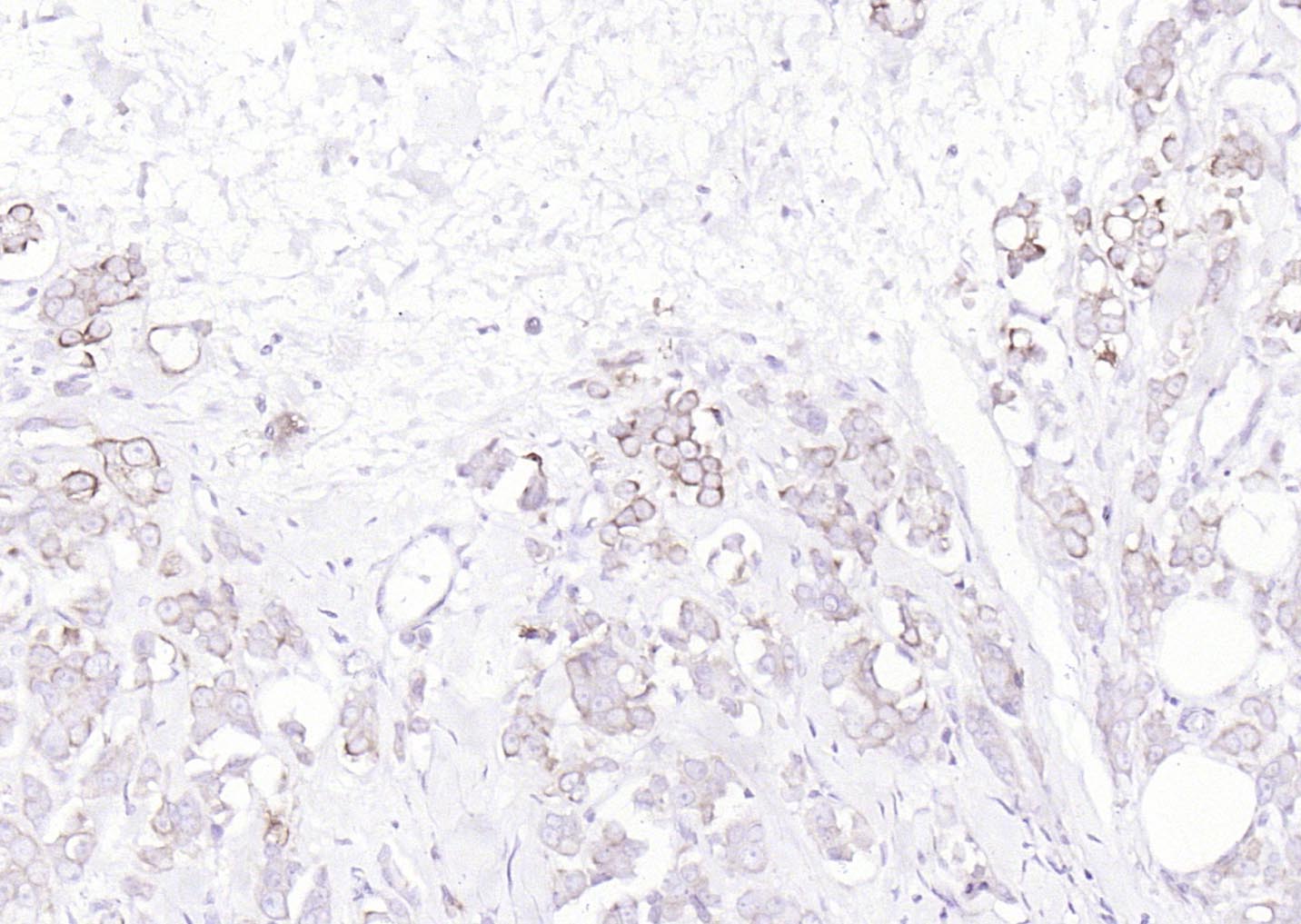 广谱细胞角蛋白PCK抗体