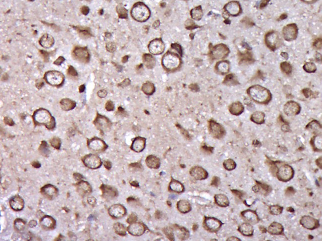 原肌球蛋白调节蛋白3抗体-bs-17156R