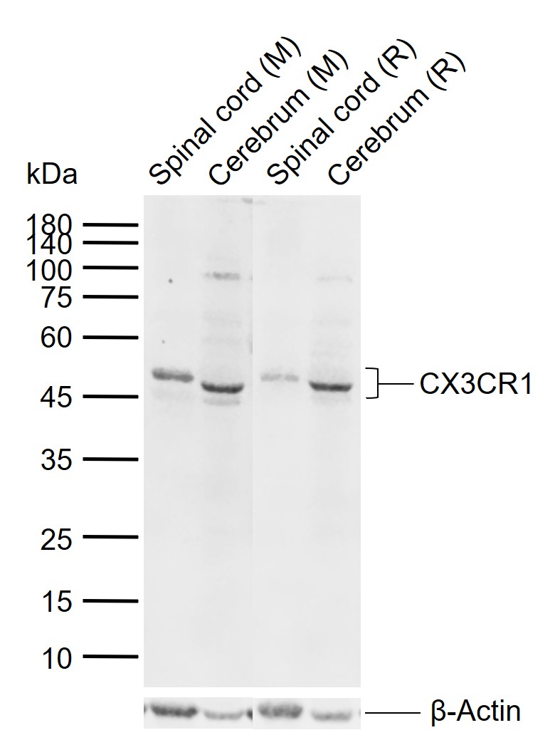 CX3CR1 Rabbit pAb (一抗) | Bioss
