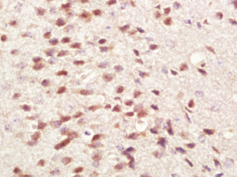 磷酸化Src原癌基因抗体-bs-1730R