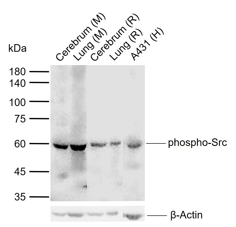 phospho-Src (Tyr529) Rabbit pAb (一抗) - WB,IHC-P,IHC-F,IF,ELISA | Bioss