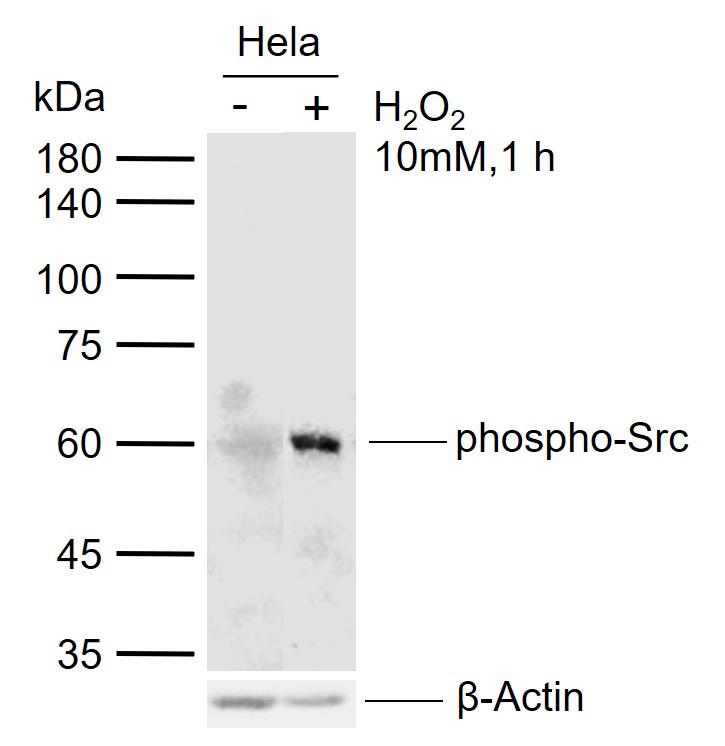 磷酸化Src原癌基因抗体-bs-1730R
