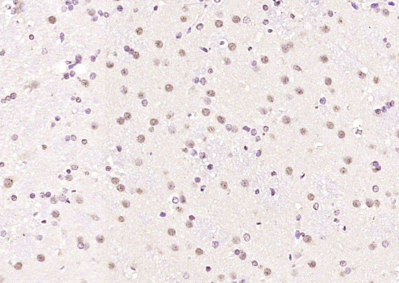 hnRNP M1-M4 Rabbit pAb (一抗) | Bioss