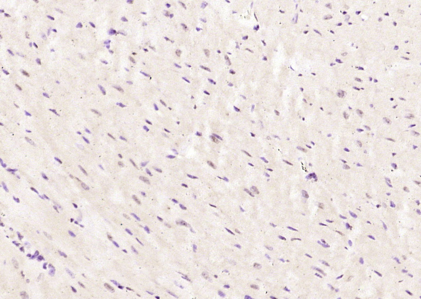 异质核糖核蛋白M1-M4抗体-bs-17335R