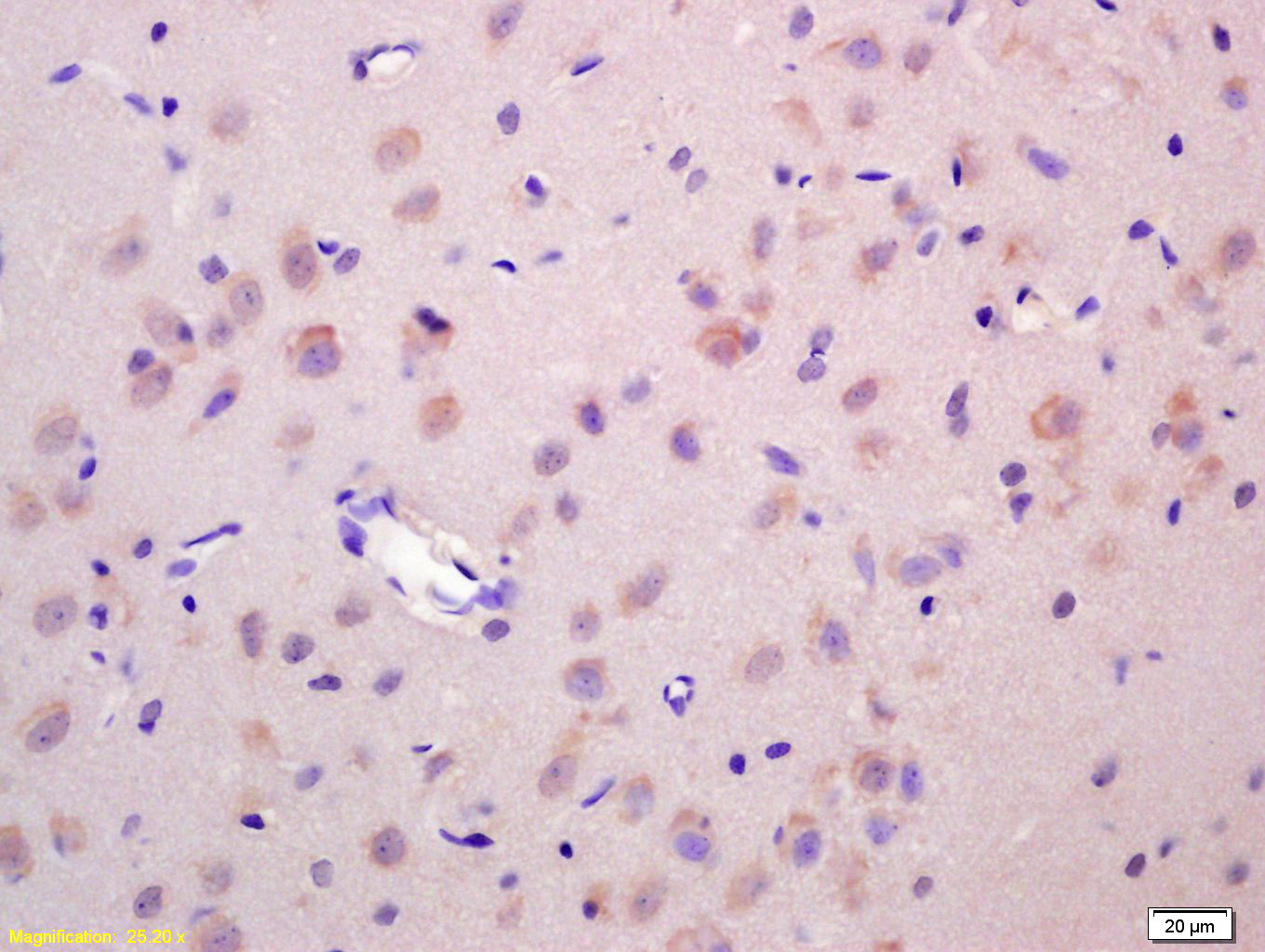 Wnt1 Rabbit pAb (一抗) | Bioss