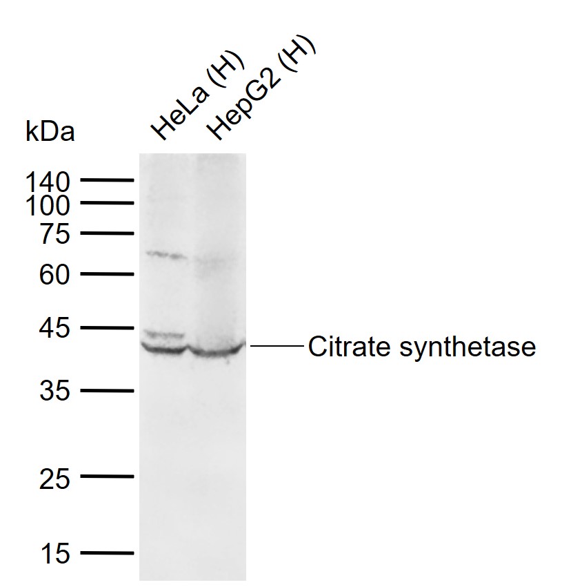Citrate synthetase Rabbit pAb (一抗) | Bioss