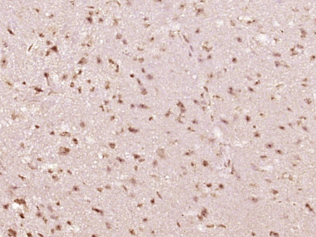 phospho-STAT6 (Tyr641) Rabbit pAb (一抗) | Bioss
