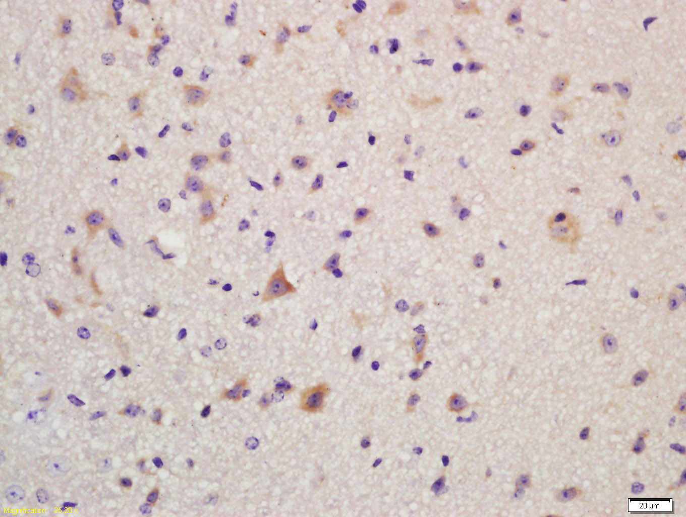 谷氨酸受体2抗体-bs-1798R