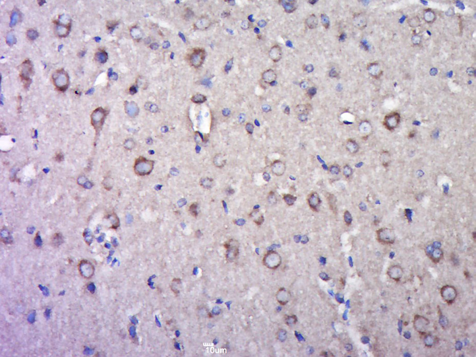 谷氨酸受体2抗体-bs-1798R