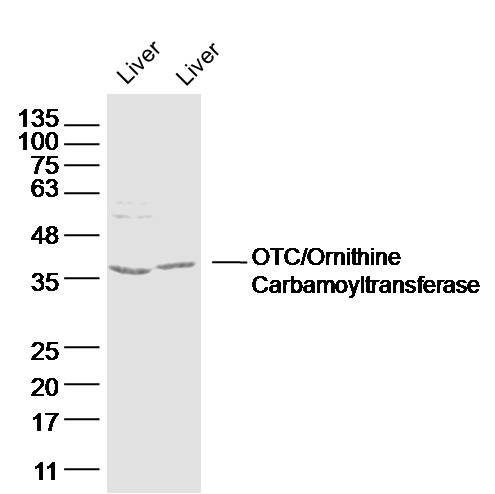 OTC/Ornithine Carbamoyltransferase Rabbit pAb (一抗) | Bioss