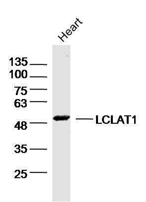 LCLAT1 Rabbit pAb (一抗) | Bioss