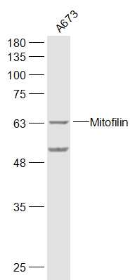 线粒体内膜蛋白抗体-bs-1824R