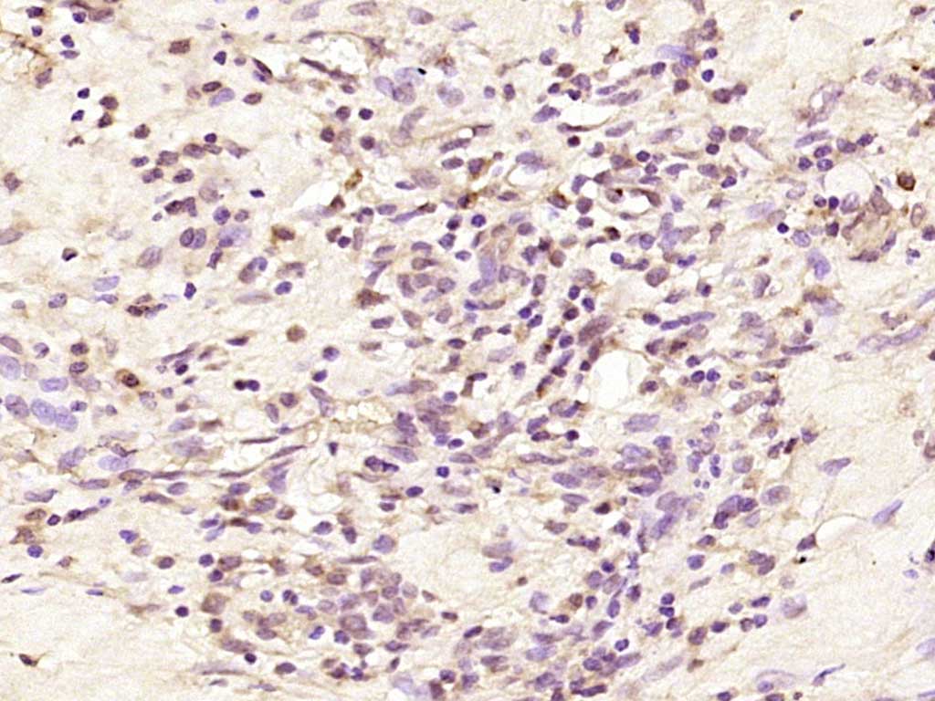 LOR/Loricrin Rabbit pAb (一抗) - IHC-P,IHC-F,IF | Bioss