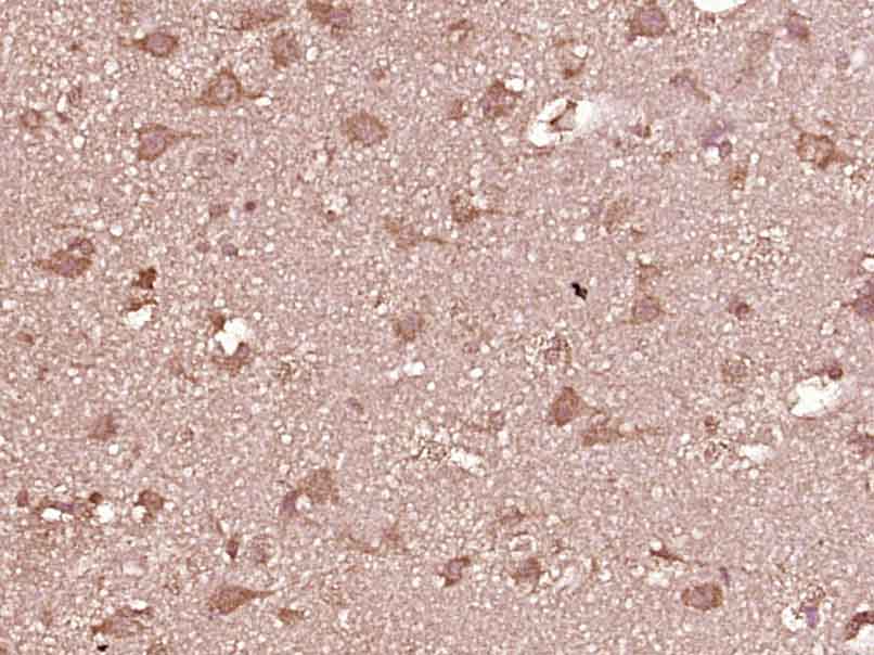 基质金属蛋白酶-12抗体-bs-1854R