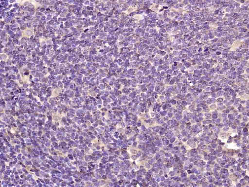 RUNX1 / AML1 + RUNX3 + RUNX2 Rabbit pAb (一抗) | Bioss