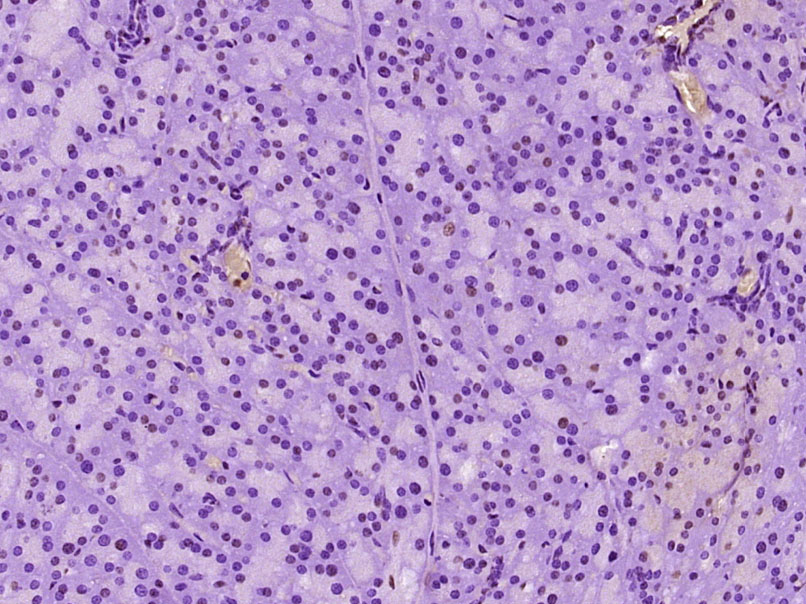 RREB1 Rabbit pAb (一抗) | Bioss