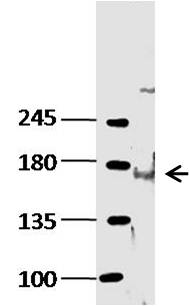 KDM6B Rabbit pAb (一抗) | Bioss