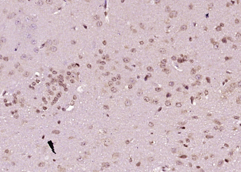 磷酸化细胞信号转导分子SMAD7抗体-bs-20024R
