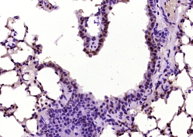 磷酸化细胞信号转导分子SMAD7抗体-bs-20024R