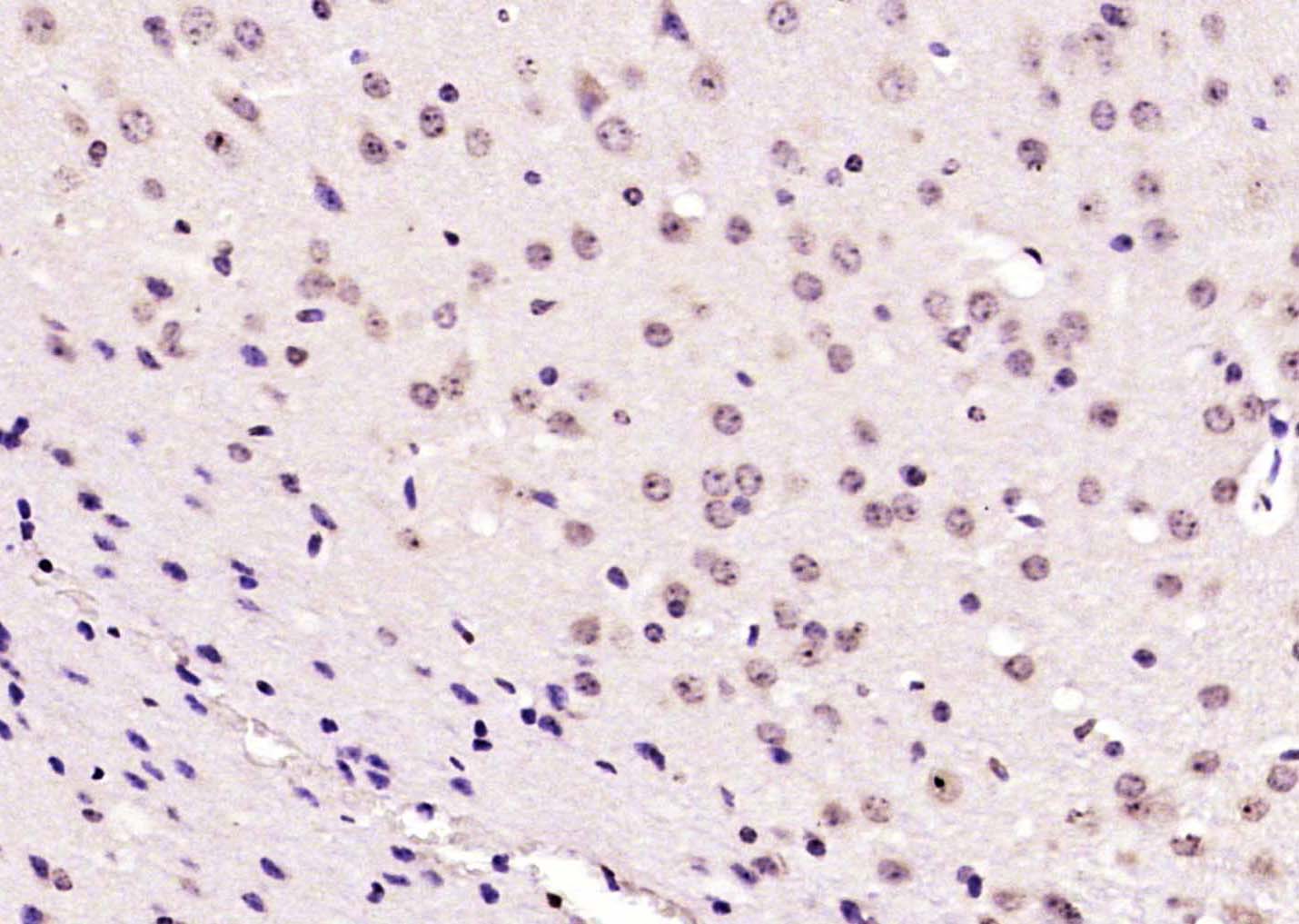 phospho-CDK9 (Thr29) Rabbit pAb (一抗) | Bioss