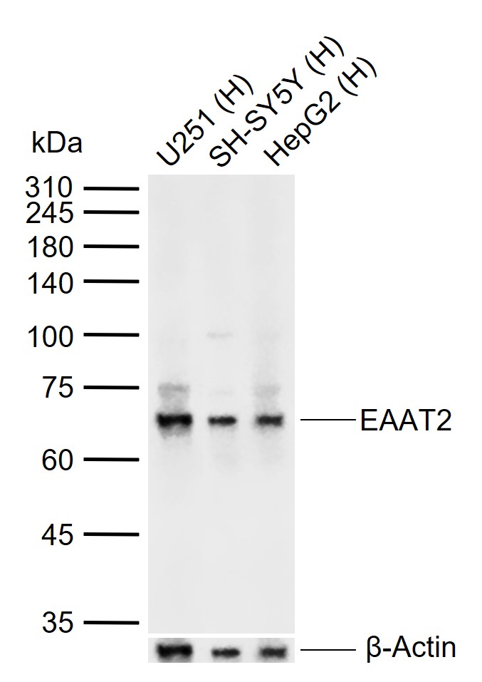EAAT2 Rabbit pAb (一抗) - WB | Bioss