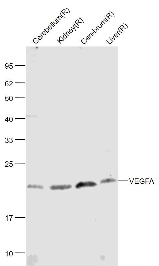 VEGFA Rabbit pAb (一抗) | Bioss