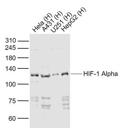 缺氧诱导因子1α /HIF-1α抗体-bs-20399R