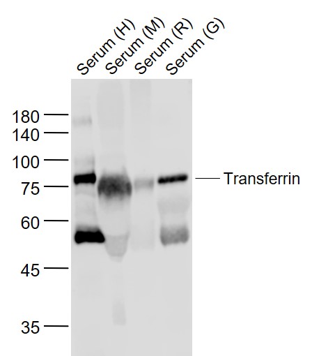 Transferrin Rabbit pAb (一抗) | Bioss