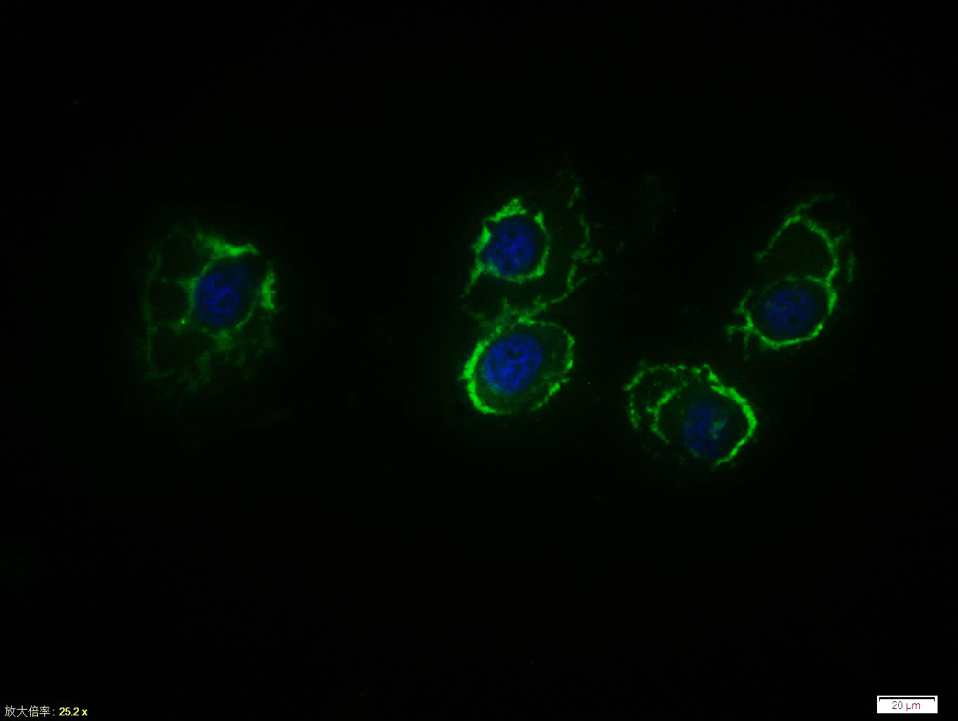 β-连环蛋白/β-连环素/β链接素抗体-bs-20598R